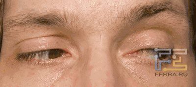 eyes1