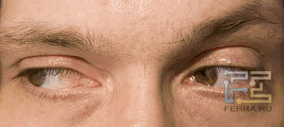 eyes2